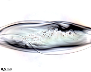 Défaut de matière – nœud vitreux